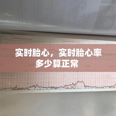 实时胎心，实时胎心率多少算正常 