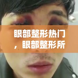 眼部整形热门，眼部整形所有项目 