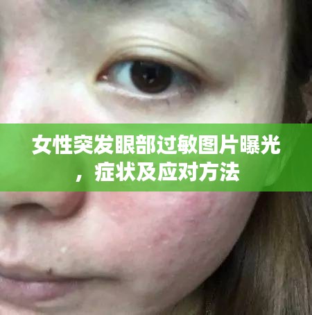 女性突发眼部过敏图片曝光，症状及应对方法