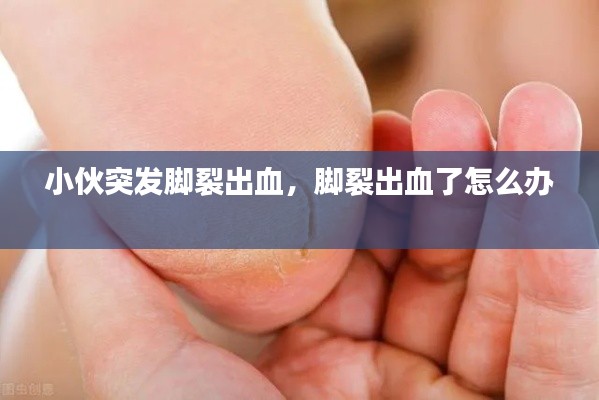 小伙突发脚裂出血，脚裂出血了怎么办 