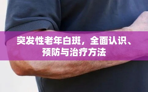 突发性老年白斑，全面认识、预防与治疗方法